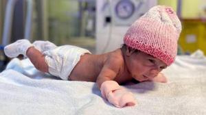 515 gram doğan bebek 98 günlük tedavisiyle sağlığına kavuştu